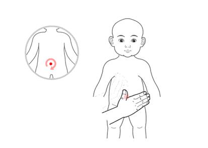 小兒推拿治療感冒嗎？