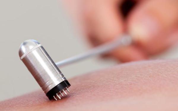 梅花針的功效是什么？